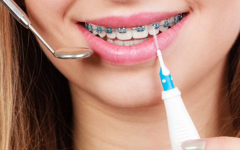 74772692_m_normal_none